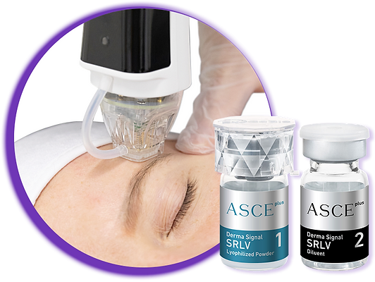 Mesotherapy / Microneedling